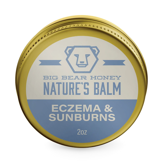 Eczema & Sunburns Balm - 2oz